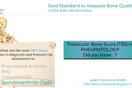 TBS-Osteo-Osteoporosis-in-Rheumatology-in-Spondyloarthritis-SpA