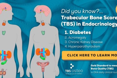 Trabecular Bone Score (TBS Osteo) in Endocrinology: Diabetes
