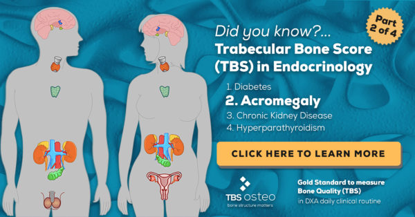 TBS Osteo - Trabecular Bone Score in Endocrinology (Acromegaly)